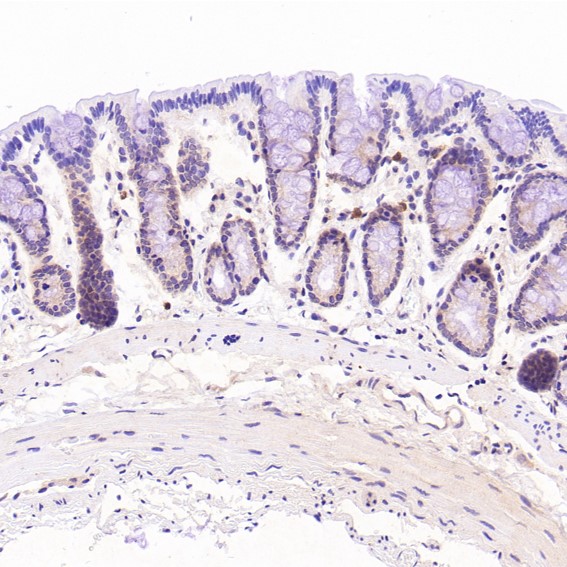 2 - Anti-CD3 epsilon Rabbit Monoclonal Antibody ABO14080