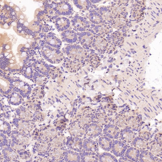2 - Anti-CD3 epsilon Rabbit Monoclonal Antibody ABO14080