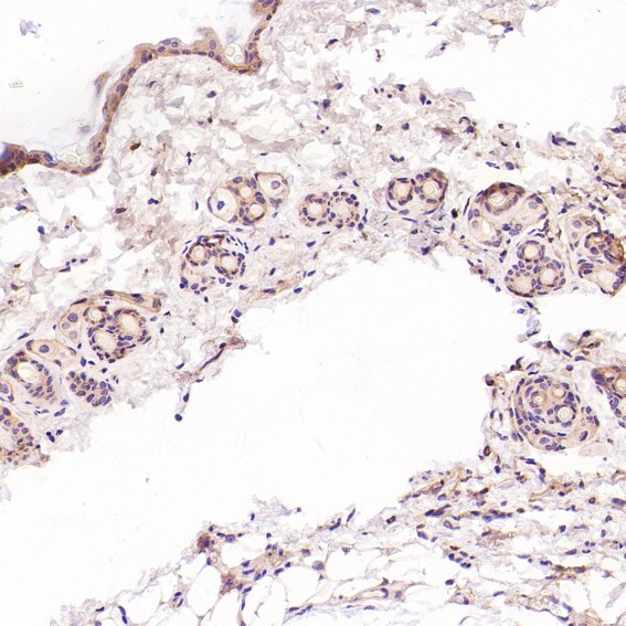 2 - Anti-CD3 epsilon Rabbit Monoclonal Antibody ABO14080