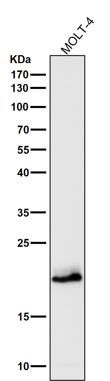 1 - Anti-CD3 epsilon Rabbit Monoclonal Antibody ABO14080