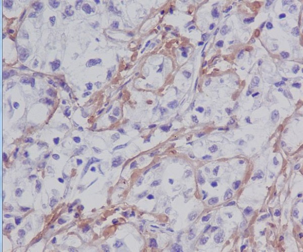 2 - Anti-Fibronectin FN1 Rabbit Monoclonal Antibody ABO14081