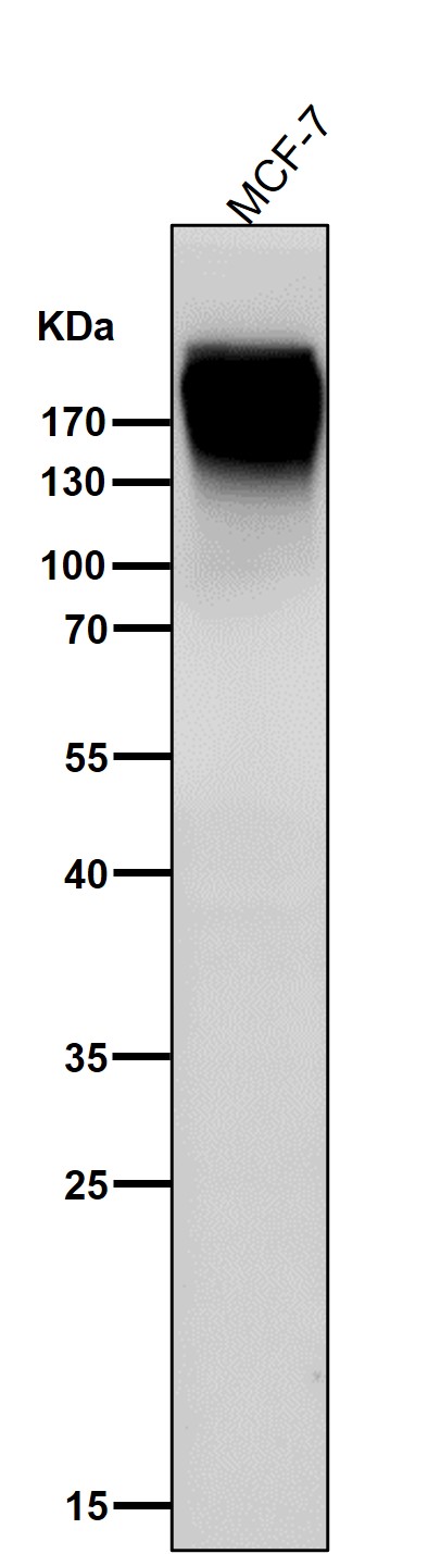 1 - Anti-Fibronectin FN1 Rabbit Monoclonal Antibody ABO14081