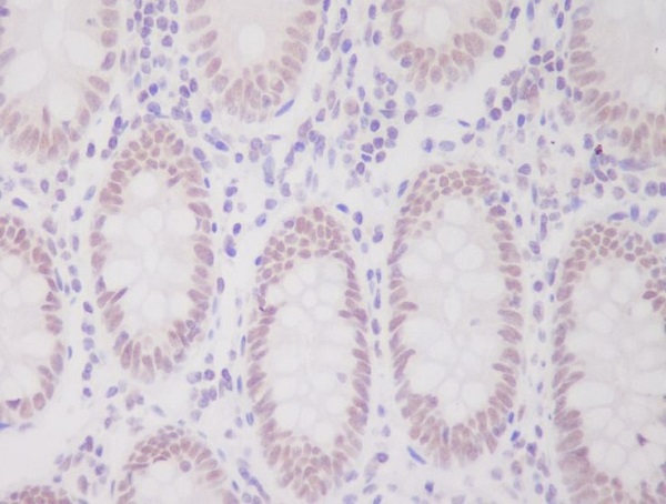 2 - Anti-hnRNP C1/C2 Rabbit Monoclonal Antibody ABO14082
