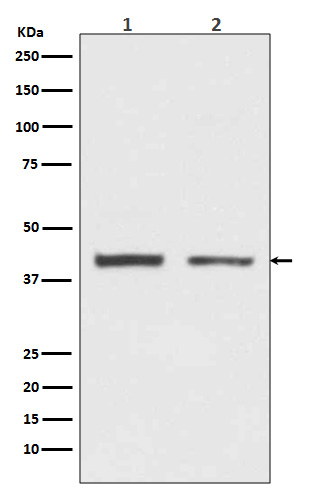 1 - Anti-hnRNP C1/C2 Rabbit Monoclonal Antibody ABO14082