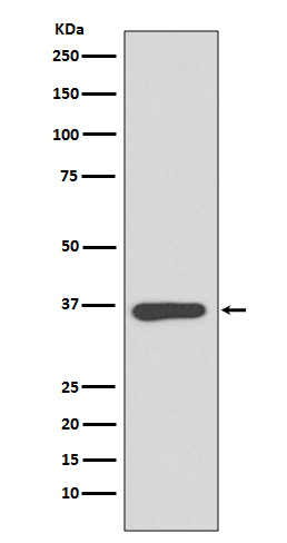 1 - Anti-Annexin A10 Rabbit Monoclonal Antibody ABO14083