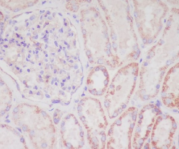 2 - Anti-Smac/Diablo Rabbit Monoclonal Antibody ABO14084