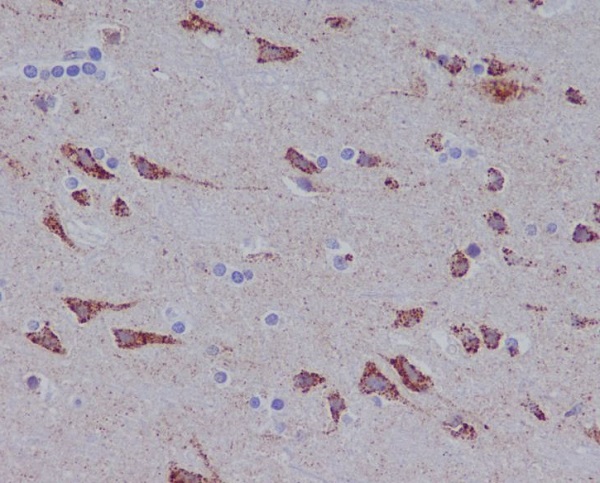 2 - Anti-Glutaminase GLS Rabbit Monoclonal Antibody ABO14085