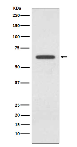 1 - Anti-Glutaminase GLS Rabbit Monoclonal Antibody ABO14085