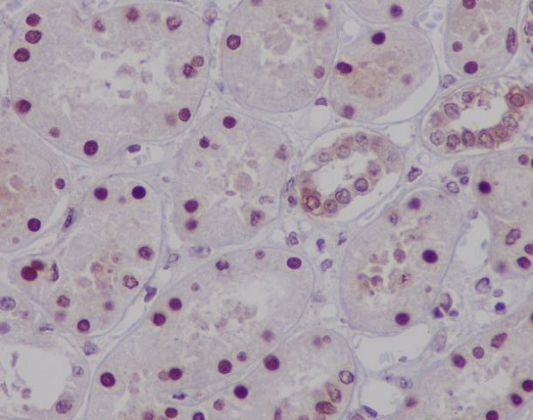 2 - Anti-HNF-4-alpha Rabbit Monoclonal Antibody ABO14086