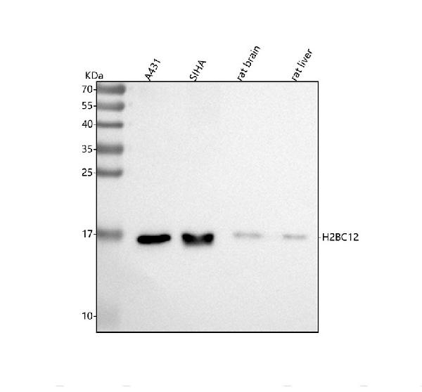 1 - Anti-Histone H2B Rabbit Monoclonal Antibody ABO14087