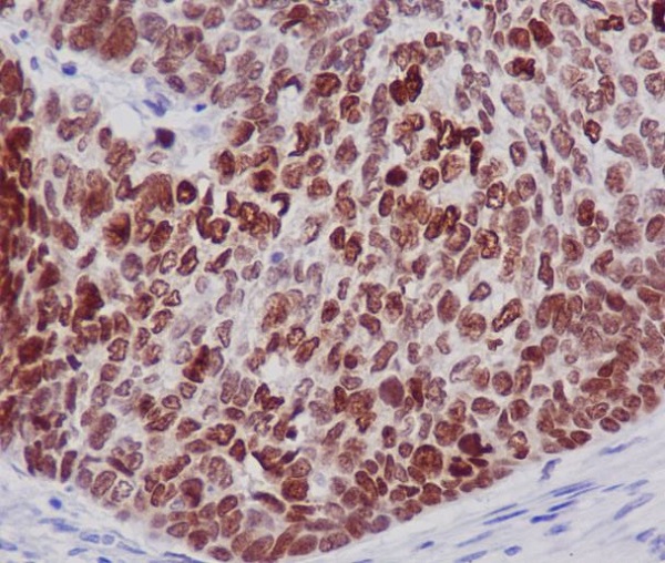 2 - Anti-Histone H2B Rabbit Monoclonal Antibody ABO14087