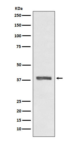 1 - Anti-AMPK beta 1 PRKAB1 Rabbit Monoclonal Antibody ABO14089