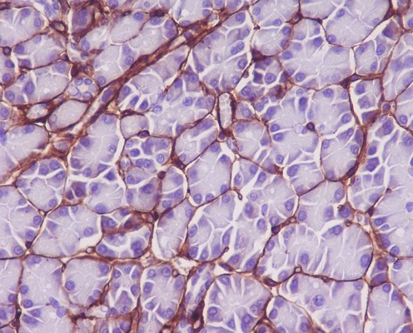 2 - Anti-Collagen VI COL6A1 Rabbit Monoclonal Antibody ABO14090