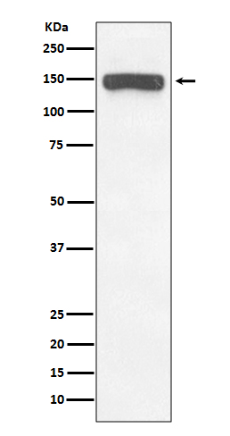 1 - Anti-Collagen VI COL6A1 Rabbit Monoclonal Antibody ABO14090