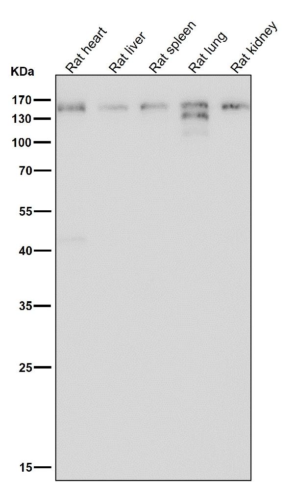 1 - Anti-Collagen VI COL6A1 Rabbit Monoclonal Antibody ABO14090