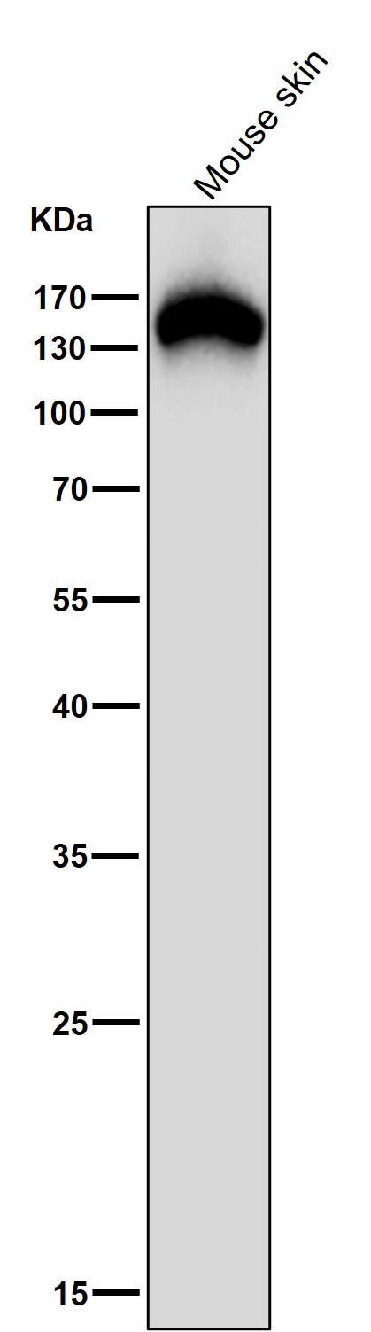 1 - Anti-Collagen VI COL6A1 Rabbit Monoclonal Antibody ABO14090