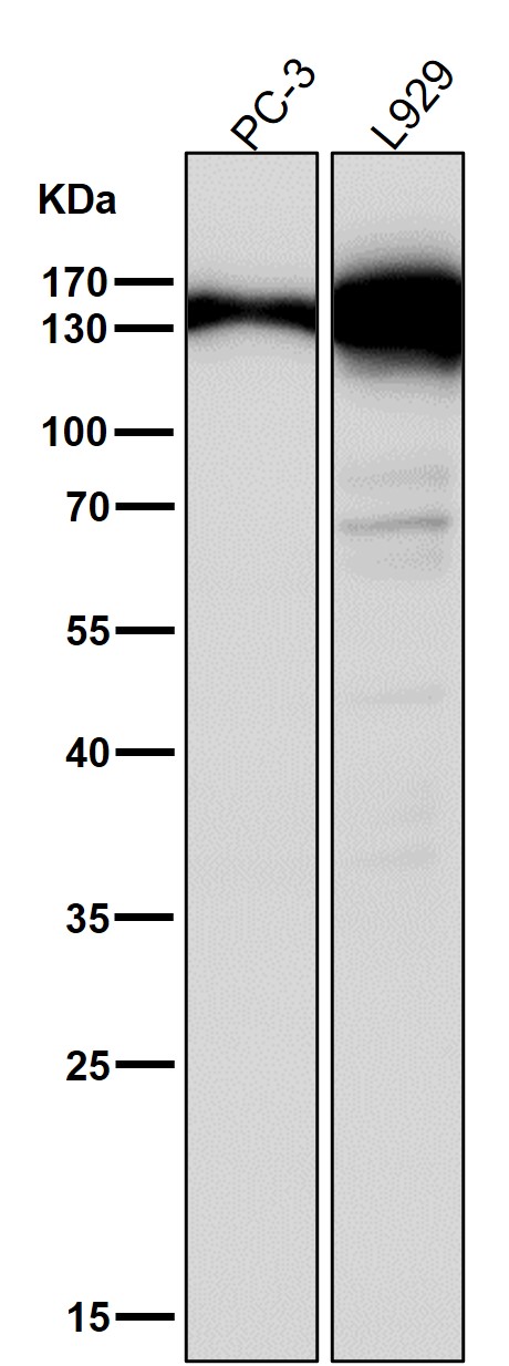 1 - Anti-Collagen VI COL6A1 Rabbit Monoclonal Antibody ABO14090