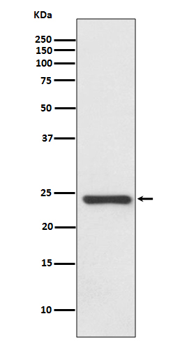 1 - Anti-HSPB8/HSP22 Rabbit Monoclonal Antibody ABO14092
