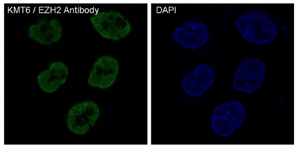 3 - Anti-KMT6 / EZH2 Rabbit Monoclonal Antibody ABO14093
