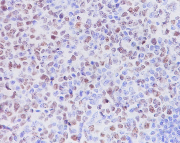 2 - Anti-KMT6 / EZH2 Rabbit Monoclonal Antibody ABO14093