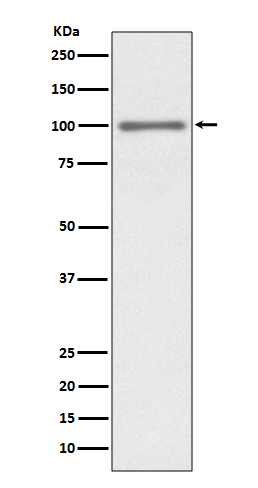 1 - Anti-KMT6 / EZH2 Rabbit Monoclonal Antibody ABO14093