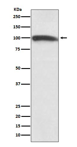 1 - Anti-KMT6 / EZH2 Rabbit Monoclonal Antibody ABO14095