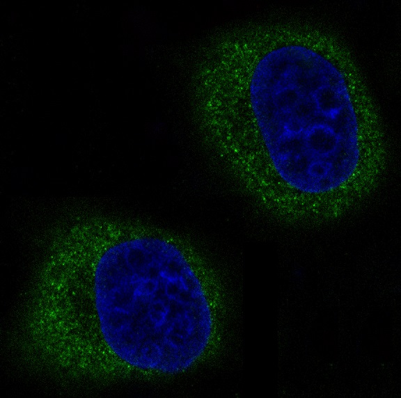 3 - Anti-Mitofusin 2 MFN2 Rabbit Monoclonal Antibody ABO14096