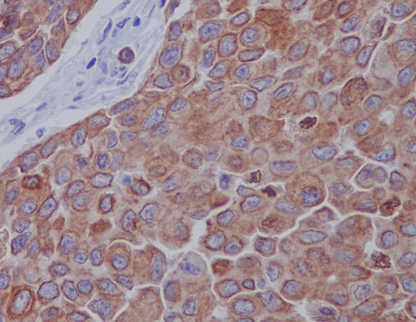 2 - Anti-Mitofusin 2 MFN2 Rabbit Monoclonal Antibody ABO14096
