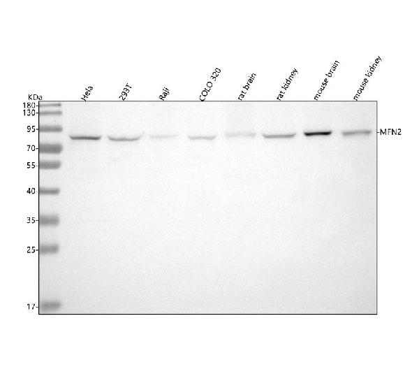 1 - Anti-Mitofusin 2 MFN2 Rabbit Monoclonal Antibody ABO14096