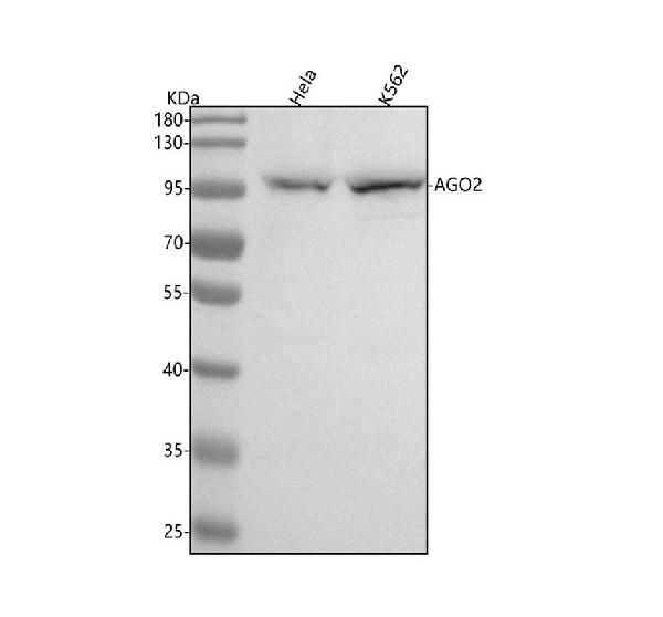 1 - Anti-Argonaute 2 AGO2 Rabbit Monoclonal Antibody ABO14097
