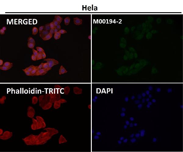 1 - Anti-MHC class I HLA-A Rabbit Monoclonal Antibody ABO14099