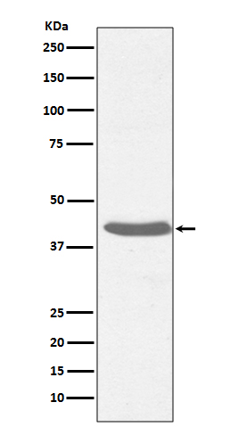 1 - Anti-MHC class I HLA-A Rabbit Monoclonal Antibody ABO14099