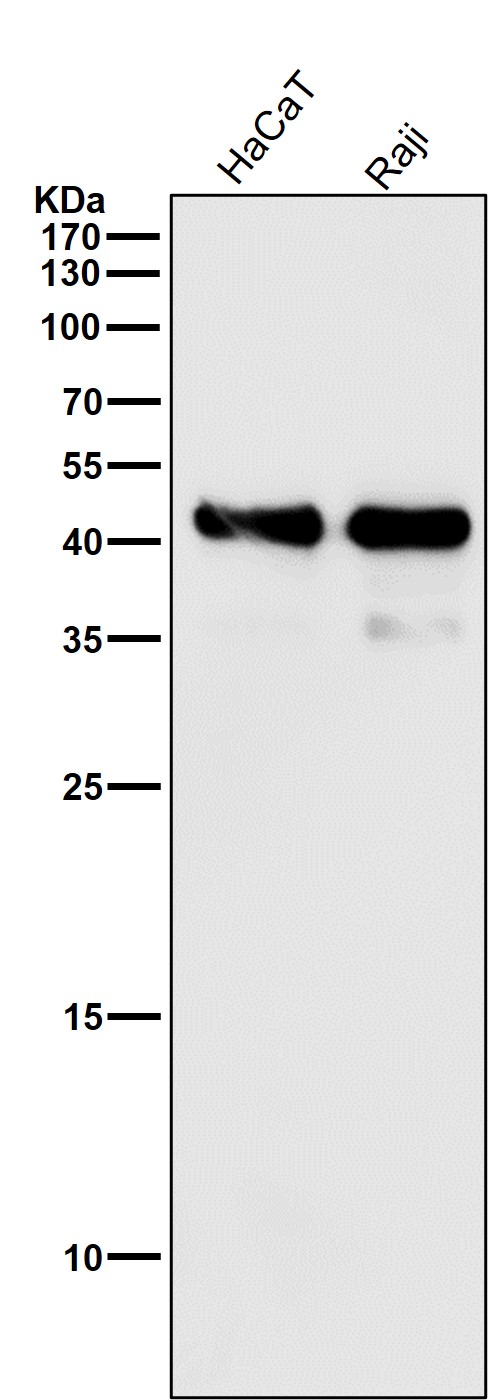 1 - Anti-MHC class I HLA-A Rabbit Monoclonal Antibody ABO14099