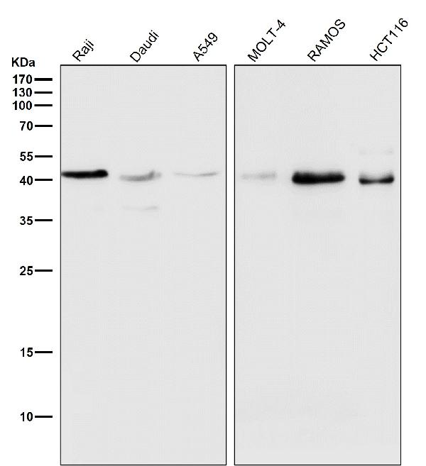 1 - Anti-MHC class I HLA-A Rabbit Monoclonal Antibody ABO14099