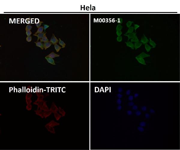 1 - Anti-CEA (CD66e) CEACAM5 Rabbit Monoclonal Antibody ABO14100