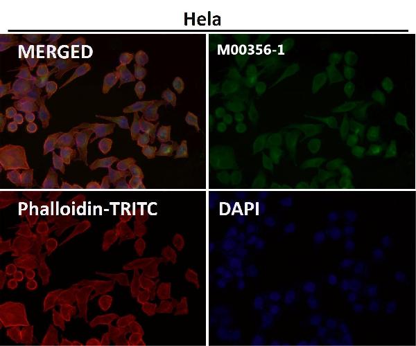 1 - Anti-CEA (CD66e) CEACAM5 Rabbit Monoclonal Antibody ABO14100