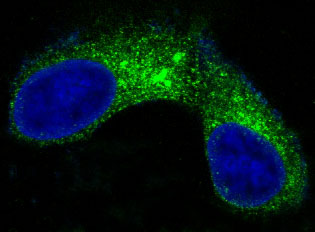 3 - Anti-CEA (CD66e) CEACAM5 Rabbit Monoclonal Antibody ABO14100