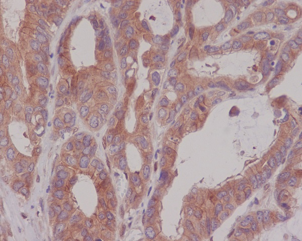 2 - Anti-CEA (CD66e) CEACAM5 Rabbit Monoclonal Antibody ABO14100