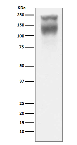 1 - Anti-CEA (CD66e) CEACAM5 Rabbit Monoclonal Antibody ABO14100