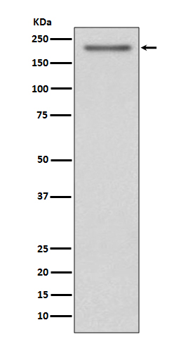 1 - Anti-PDGFR alpha Rabbit Monoclonal Antibody ABO14101
