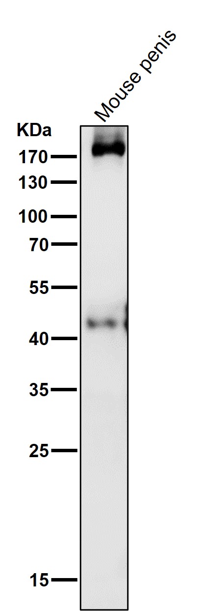 1 - Anti-PDGFR alpha Rabbit Monoclonal Antibody ABO14101