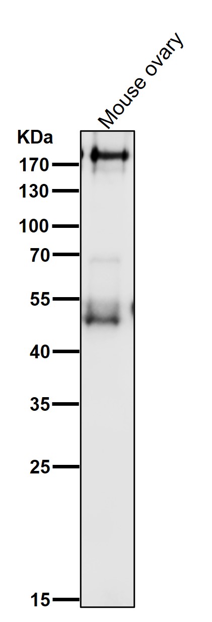 1 - Anti-PDGFR alpha Rabbit Monoclonal Antibody ABO14101