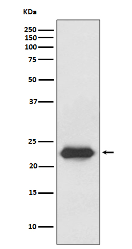 1 - Anti-Lipocalin-2 LCN2 Rabbit Monoclonal Antibody ABO14102