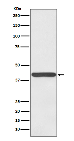 1 - Anti-Haptoglobin HP Rabbit Monoclonal Antibody ABO14103