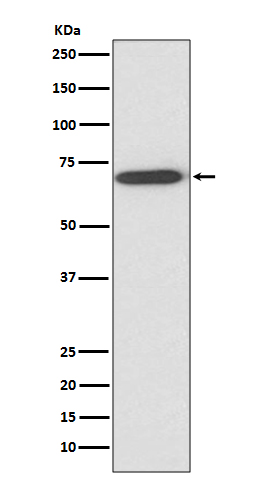 1 - Anti-Perilipin A PLIN1 Rabbit Monoclonal Antibody ABO14104