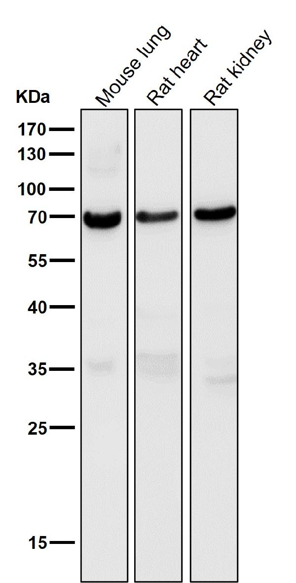 1 - Anti-Perilipin A PLIN1 Rabbit Monoclonal Antibody ABO14104