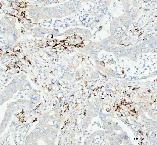 2 - Anti-Cathepsin B CTSB Rabbit Monoclonal Antibody ABO14105