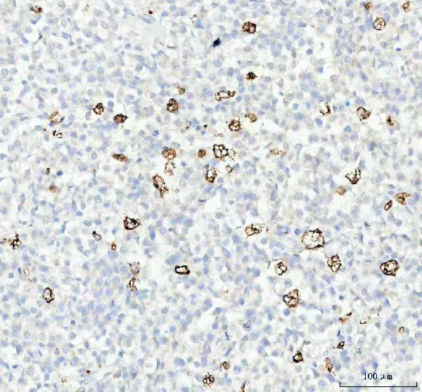 2 - Anti-Cathepsin B CTSB Rabbit Monoclonal Antibody ABO14105