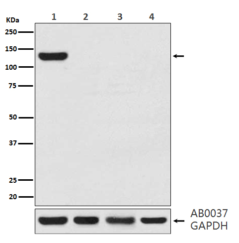 1 - Anti-CRISPR-Cas9 Rabbit Monoclonal Antibody ABO14108