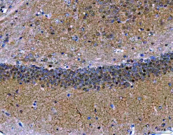 2 - Anti-MEF2A+MEF2C Rabbit Monoclonal Antibody ABO14109